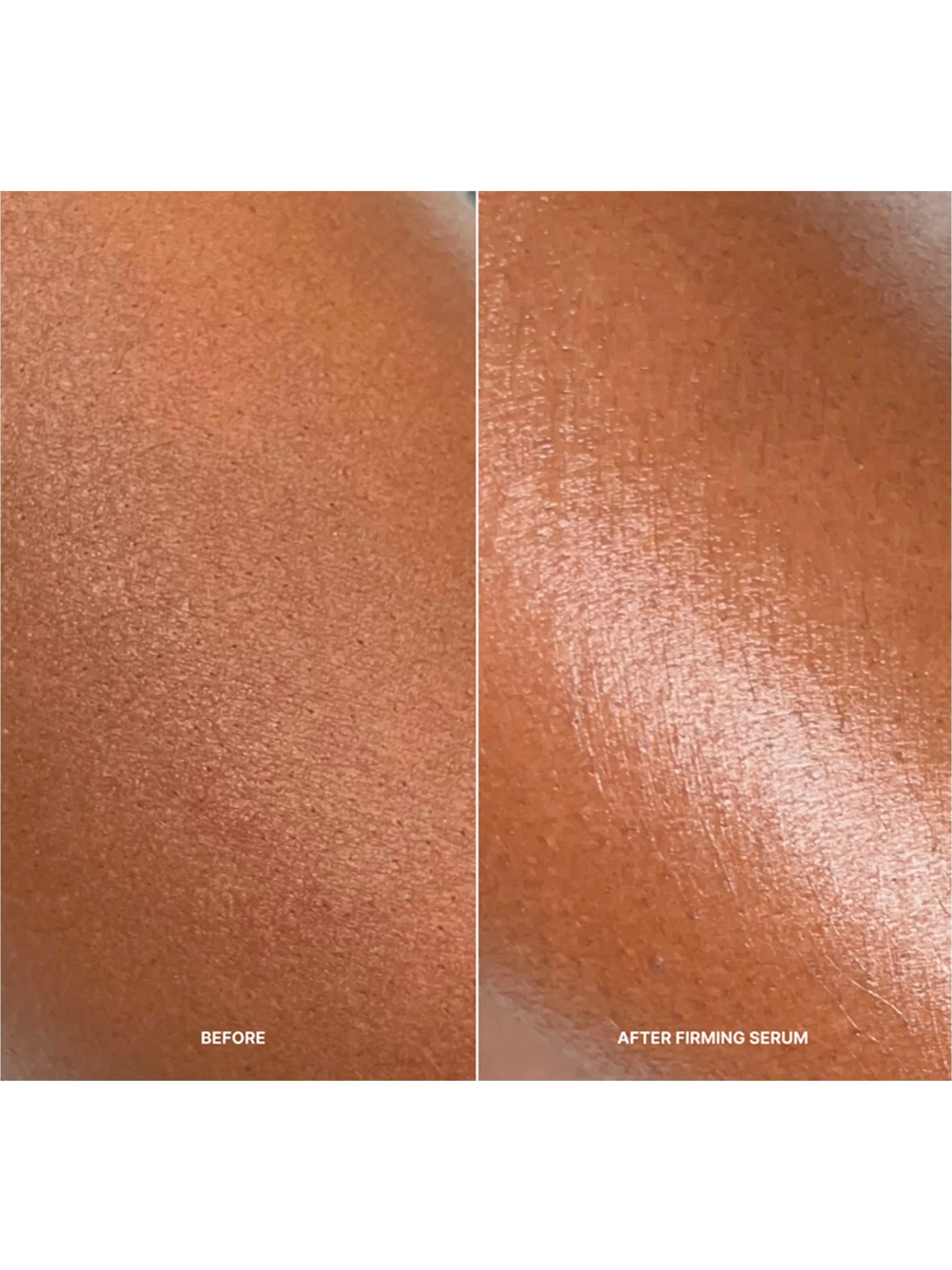 Korean Body Resurfacing™ Set